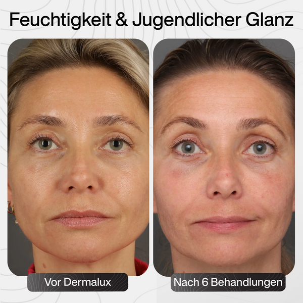 Feuchtigkeit & jugendliche Ausstrahlung