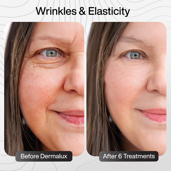 Wrinkles & Elasticity