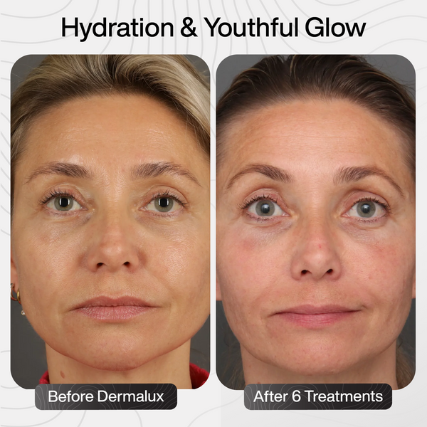 Hydration & Youthful Glow